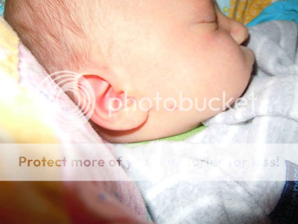 From what do birthmarks appear From what do birthmarks appear